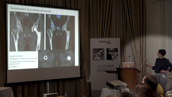 Nuclear medicine - SPECT-CT: current state and clinical applications