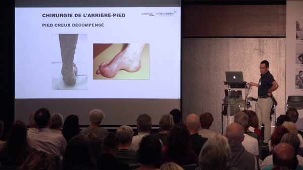 Benefits of physiotherapy in postoperative hindfoot surgery