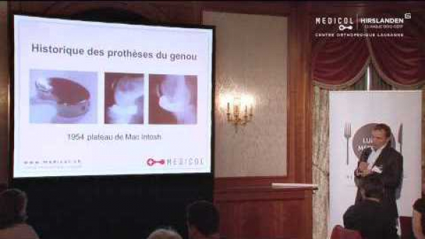 Knee prostheses: new advances