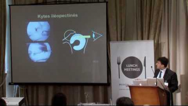 Innovation in hip pain treatments: from arthroscopy to prosthesis