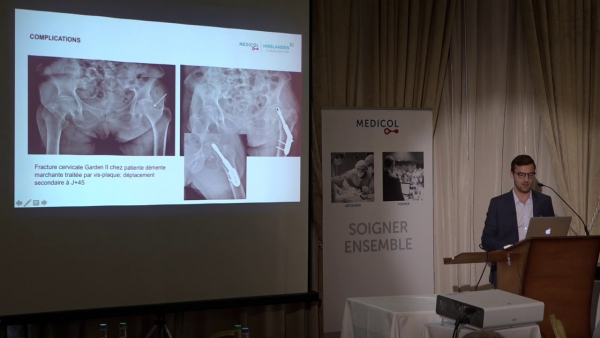 Traumatology: Injuries in the Elderly