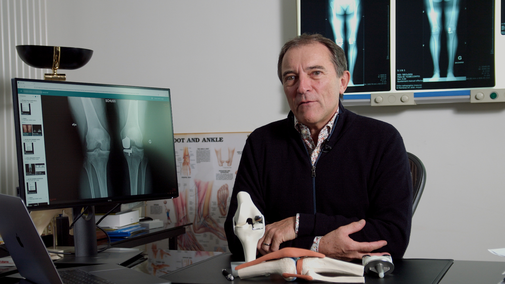 Revision surgery after knee replacement: prioritizing the functional outcome