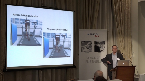 Knee: the patellofemoral